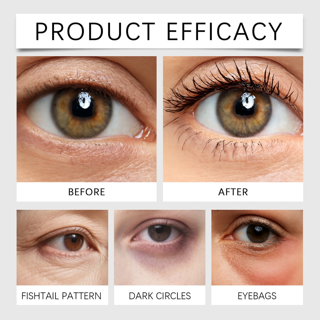 كريم منطقة العين مضاد للشيخوخة والانتفاخ | Anti-Aging Eye Cream Deep Hydration Day & Night
