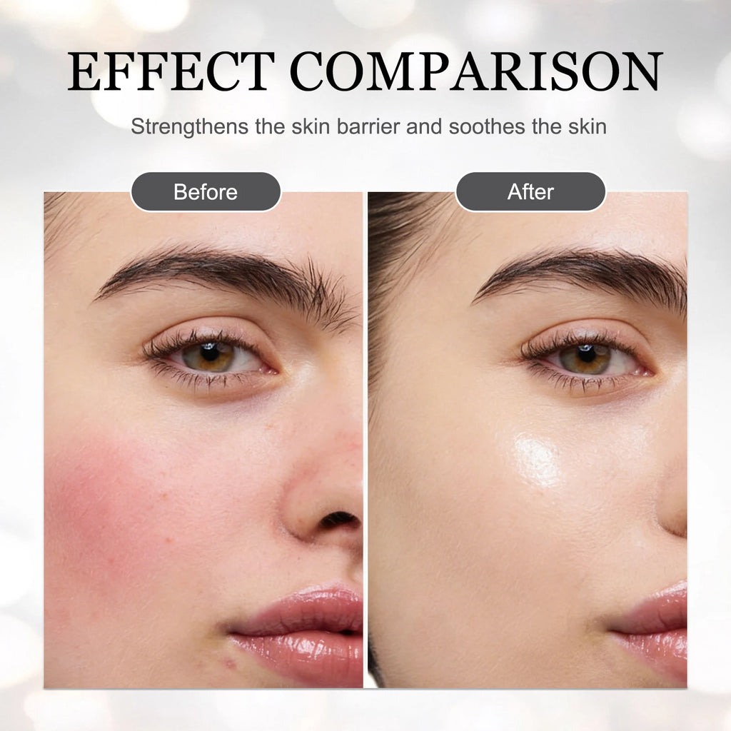 Madagascar Snowgrass Nicotinamide Essence 55ml - Soothes Uneven Tone & Supports Radiance for a Clear, Glowing Complexion.