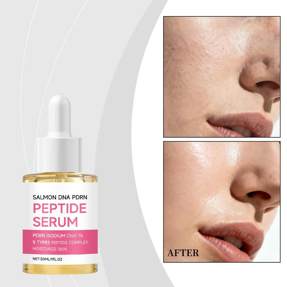 Salmon DNA Pdrn Peptide Serum Moisturizing Firming Lifting Revitalizing Brightening Smoothing Repair Facial Serum