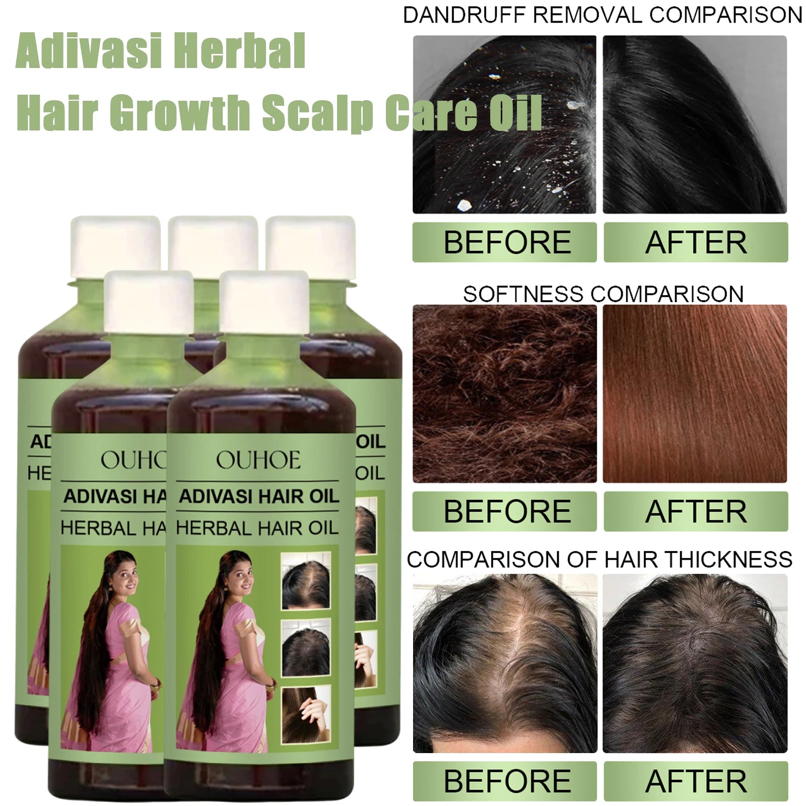 زيت نمو الشعر الهندي Adivasi بالروزماري 100مل مغذي ومرمم | Hair Growth Oil Adivasi Rosemary 100ml Nourishing Repair Scalp