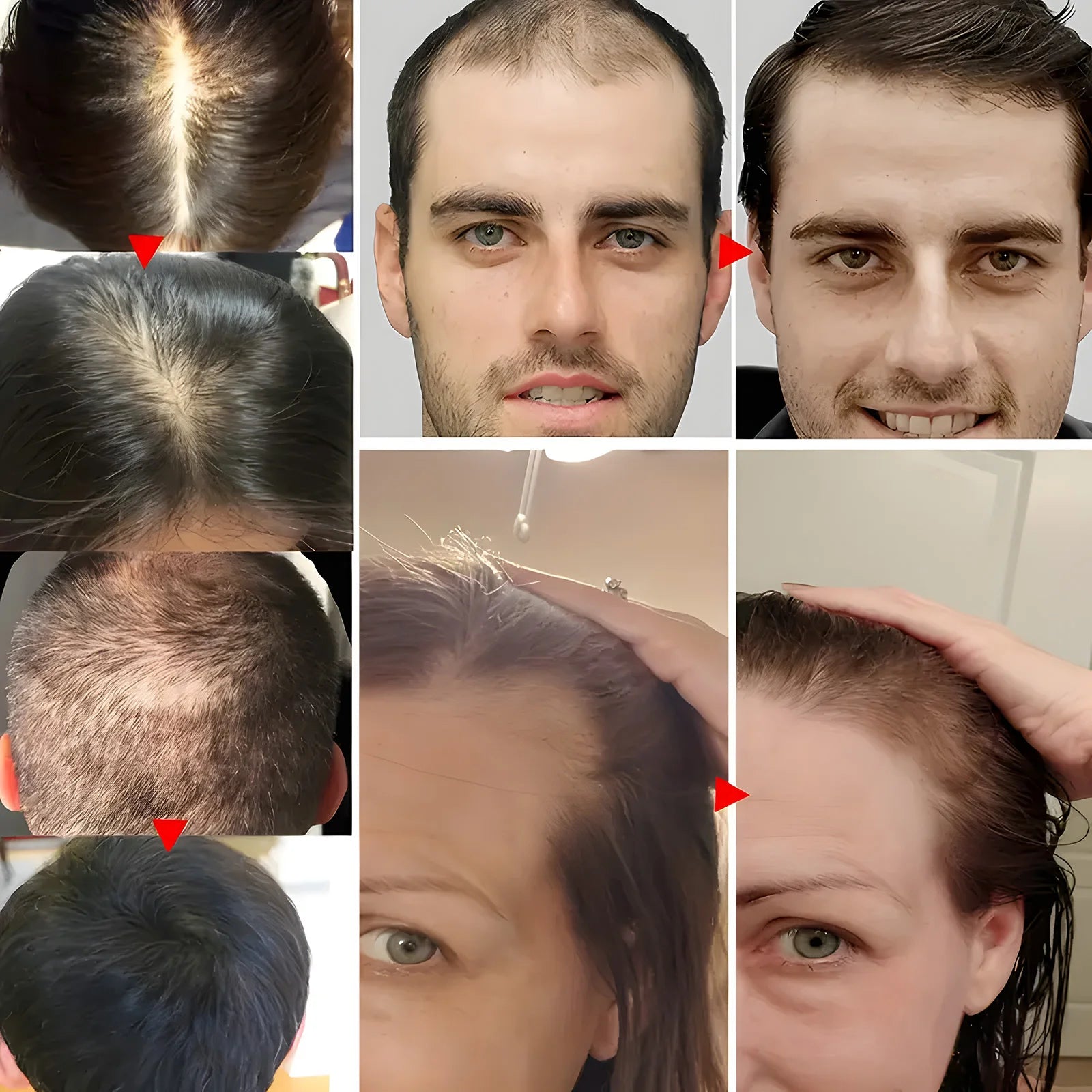 زيت الشعر المغربي بمستخلصات نباتية لإصلاح التجعد والتشابك | Moroccan Hair Oil Plant Extracts Repair Frizz Tangles Hair Care