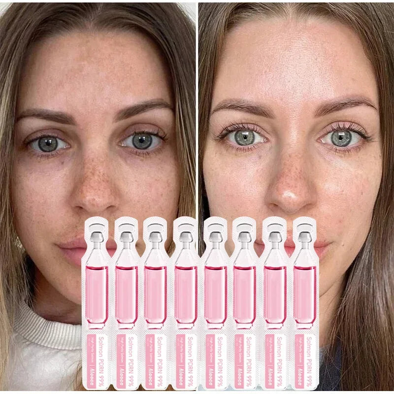 سيروم PDRN الكوري بخلاصة السالمون 10 أمبولات | PDRN Salmon Serum 10 Vials Korean Skincare