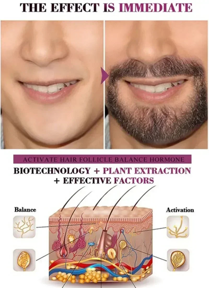 Fast Hair Growth Serum Beard Oil Axillary and Chest Hair Regrowth Fluid Longer Thicker Preventing alopecia Anti-Hair Loss