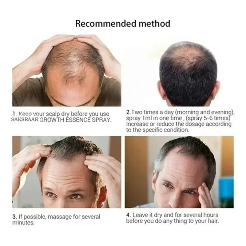 Fast Hair Growth Serum Beard Oil Axillary and Chest Hair Regrowth Fluid Longer Thicker Preventing alopecia Anti-Hair Loss